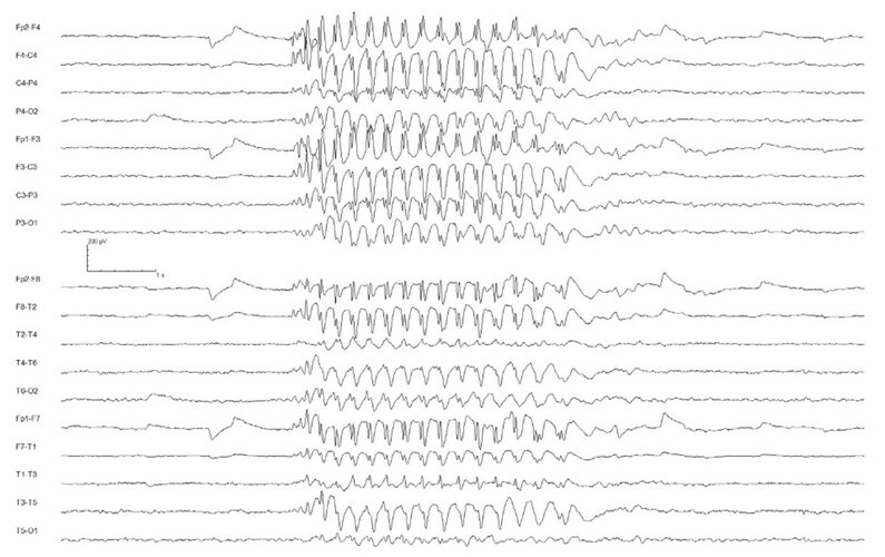 EEG_2.jpg