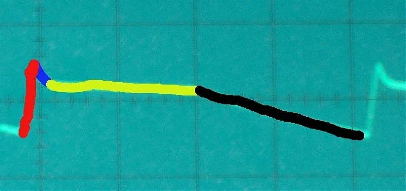 adsr 2.webp adsr 2.webp