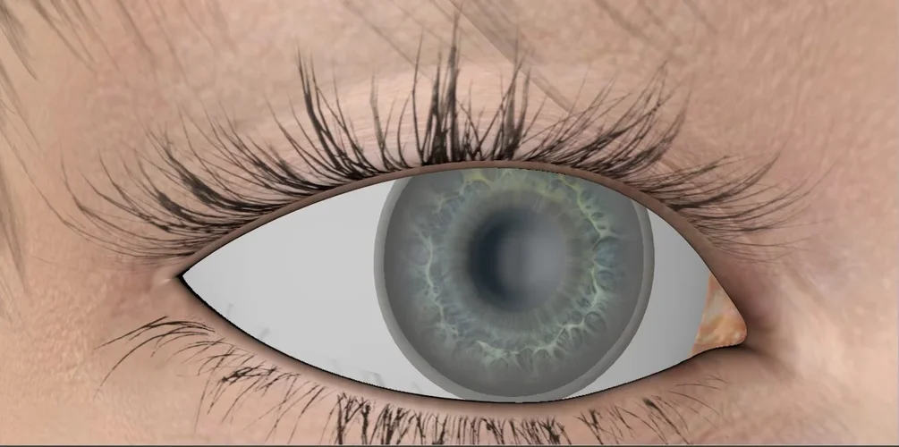 Auge Claus.JPG Auge Claus.JPG