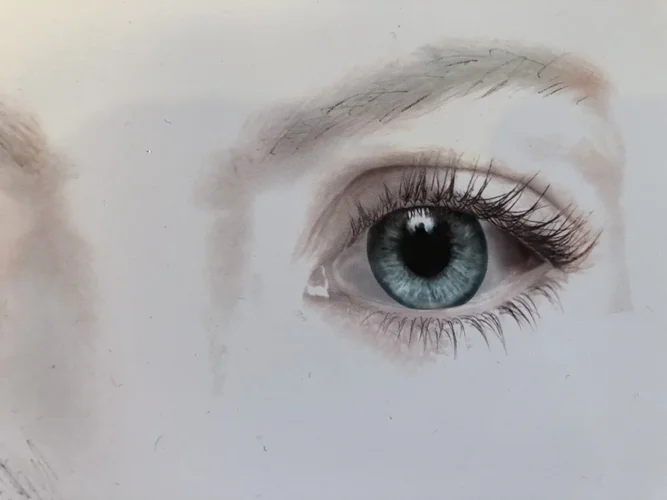 Auge links.JPG Auge links.JPG